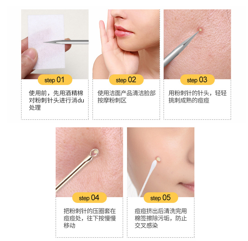 Disposable Acne/White Head Needle Mask Queen Nepal