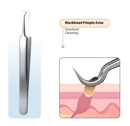 Whiteheads Blackheads Acne Clip Tweezers Mask Queen Nepal