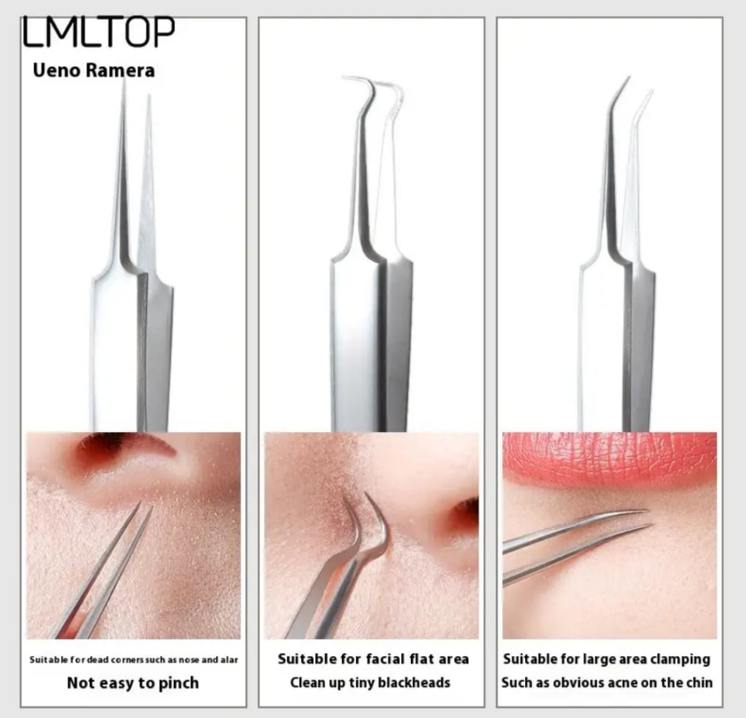 Whiteheads Blackheads Acne Clip Tweezers Mask Queen Nepal