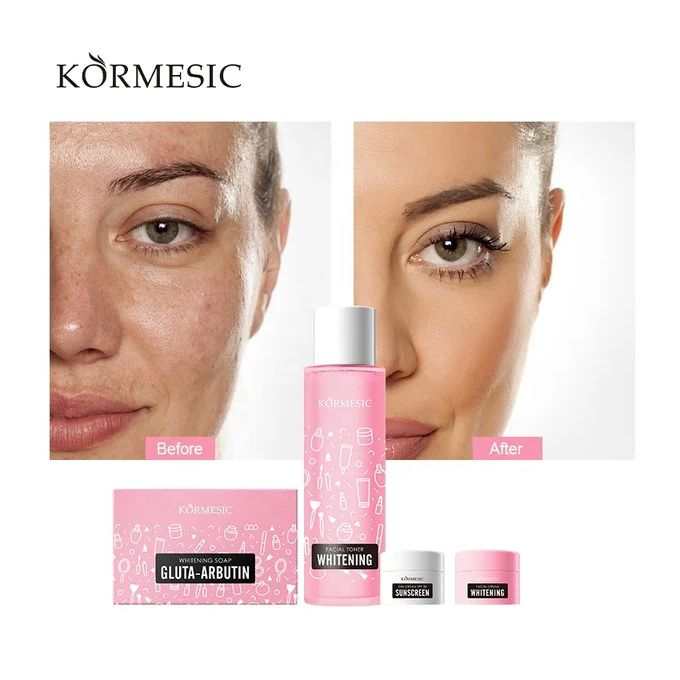 KORMESIC Whitening & Nourishing Skin Care 4pcs Set Easy Beauty Nepal