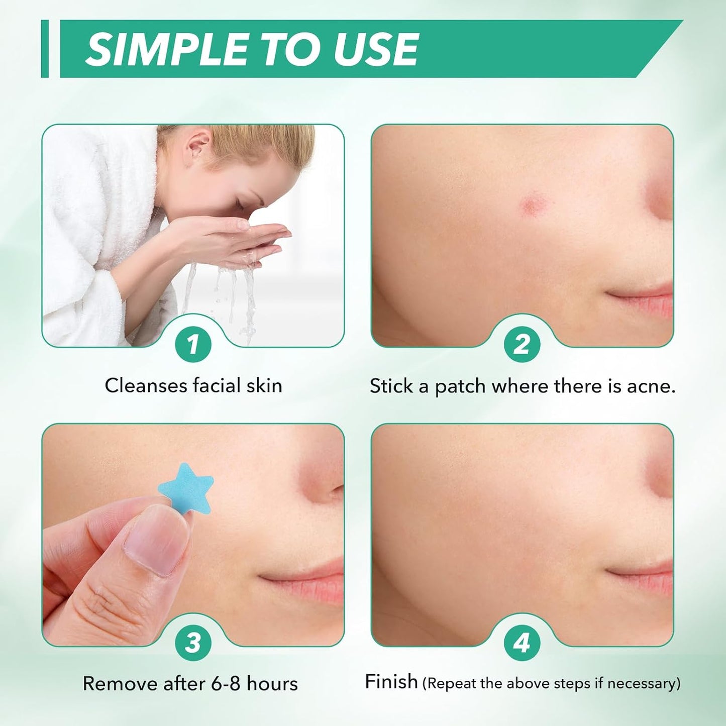 Star Shaped Pimple Patch (200 Counts) Easy Beauty Nepal