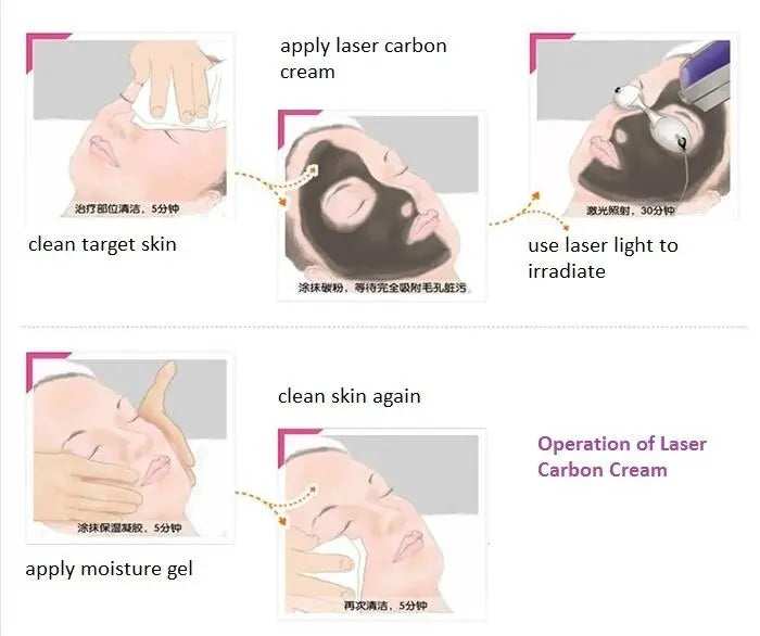 Carbon Peel Gel for Skin Rejuvenation Facial Skin Deep Cleaning Mask Queen Nepal