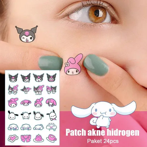 Sanrio Themed Pimple Patches (120 Counts) Easy Beauty Nepal