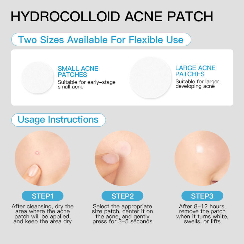 KORMESIC Hydrocolloid Acne Patch Easy Beauty Nepal
