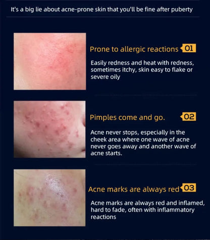 EMS Led Mask Micro Current Facemassager Mask Queen Nepal