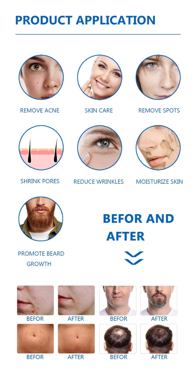 3 in 1 Derma Roller for Face Derma Roller With Titanium Needle Mask Queen Nepal