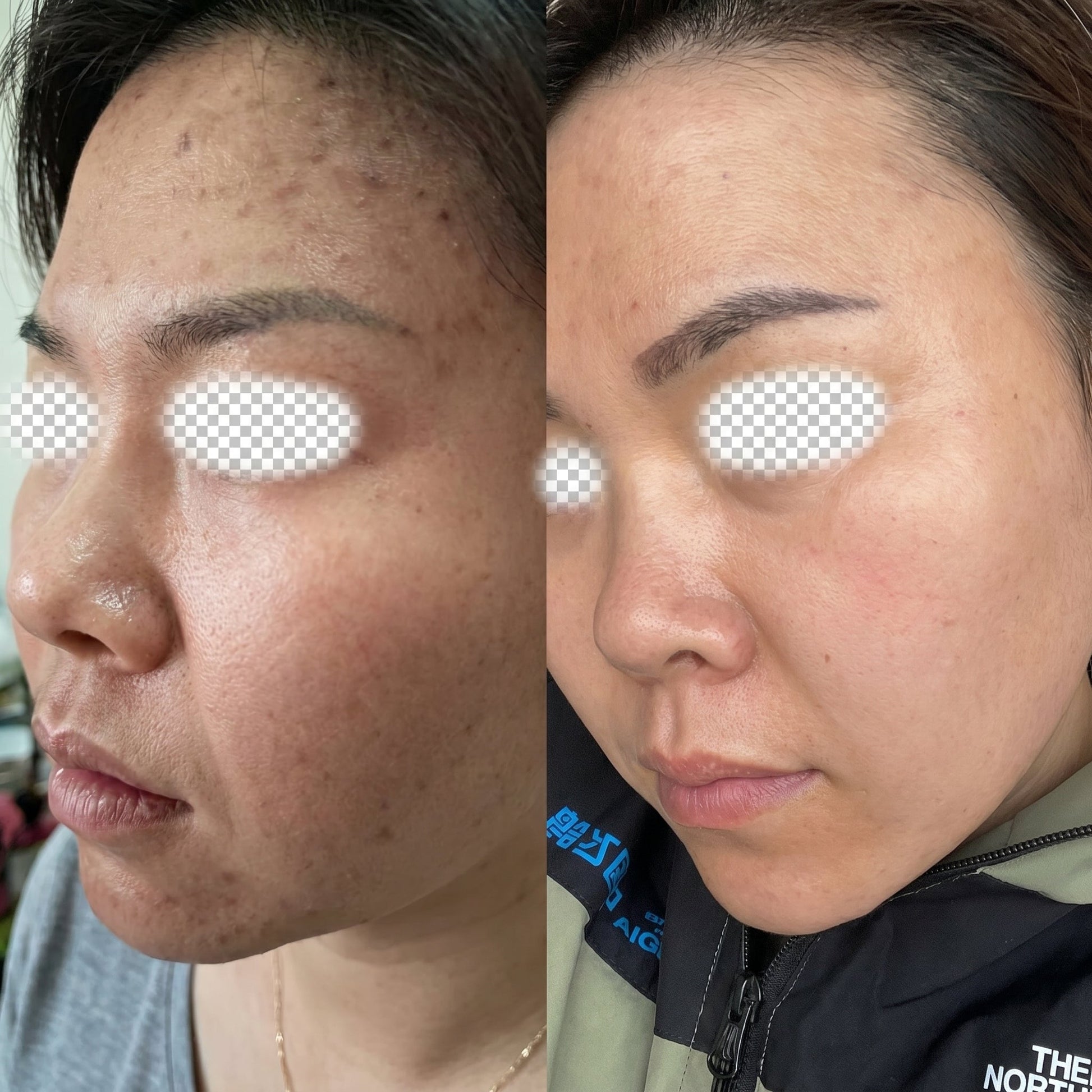 Ginsenoside Essence Cream & Liquid 30ml Easy Beauty Nepal