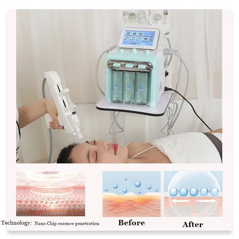 7 in 1 Hydra Facial Machine for Salons - Mask Queen Nepal