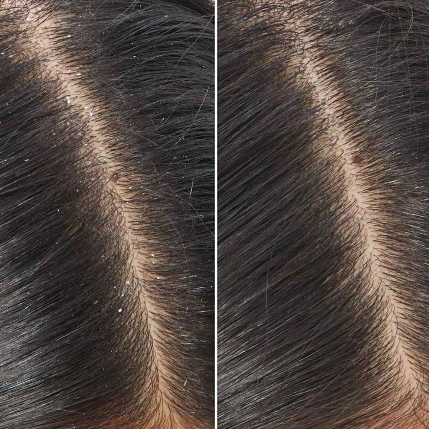 Sinko Styling Australian Botanical Hair Care Products Mask Queen Nepal