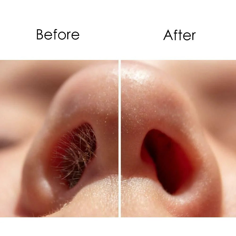Nose Hair Removal Wax Kit Painless Nasal Waxing Remover Mask Queen Nepal