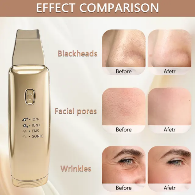Small Portable Microcurrent Ultrasonic Facial Skin Machine Mask Queen Nepal
