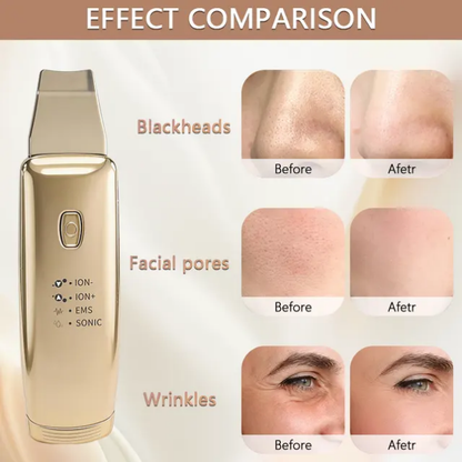 Small Portable Microcurrent Ultrasonic Facial Skin Machine Mask Queen Nepal