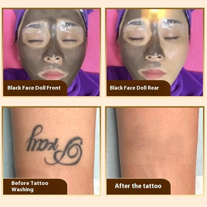 2-in-1  Diode Hair Removal + Picosecond Tattoo & Eyebrow Washing(call for price) Mask Queen Nepal